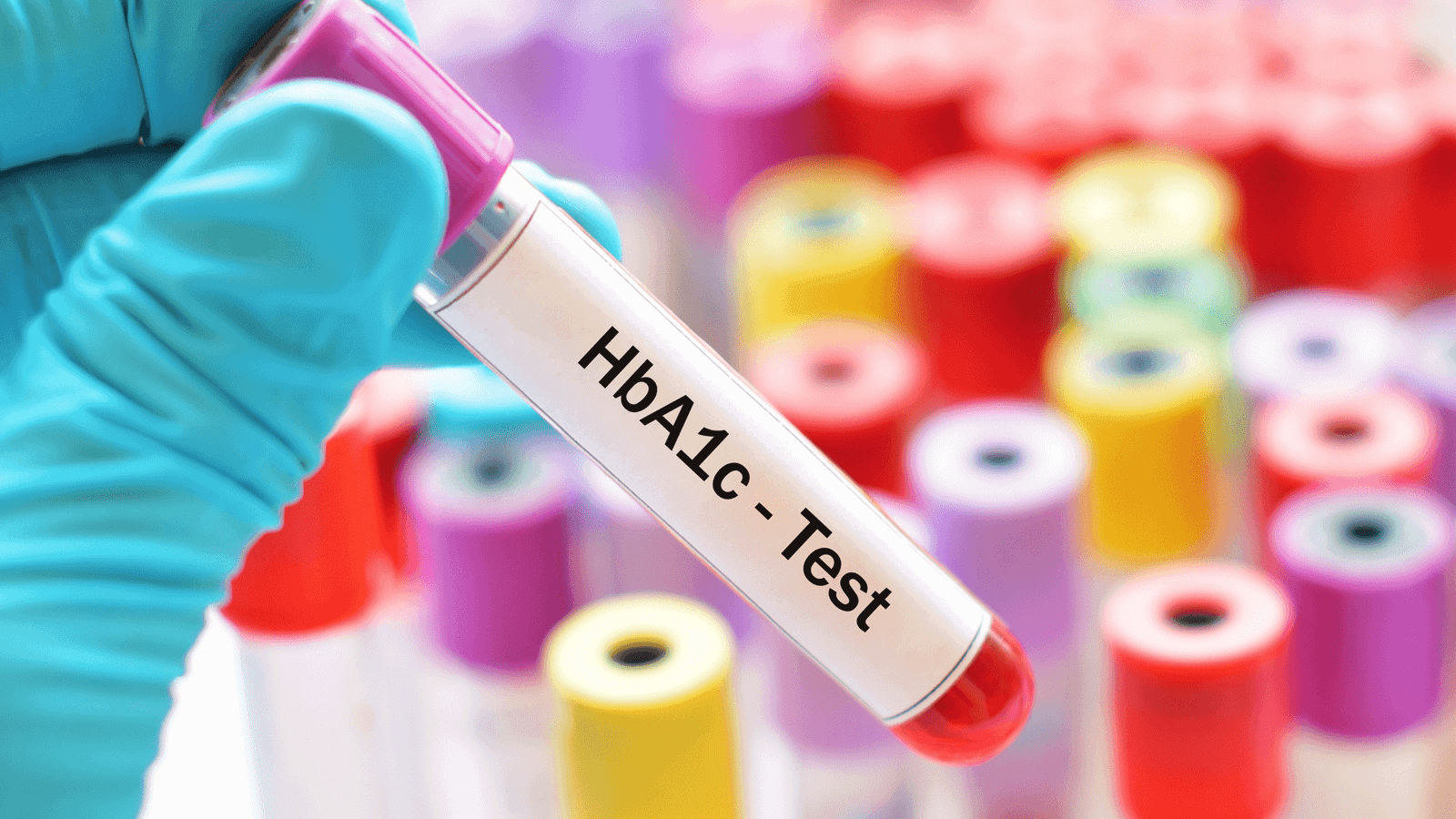 HBA1C Test