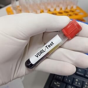 VDRL Test