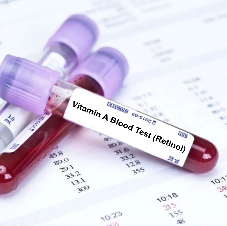 Vitamin A