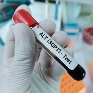 SGPT / ALT Test