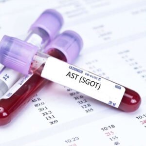 SGOT/AST Test