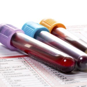 General Blood Picture