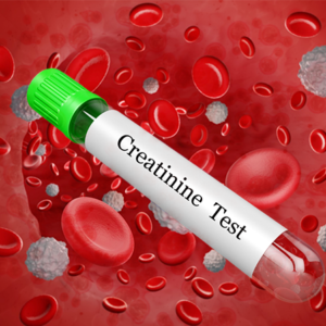 Creatinine Test