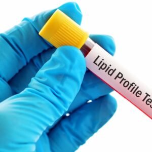 Lipid Profile