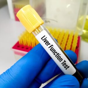 Liver Function Test (LFT) Full