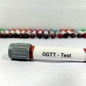 OGTT