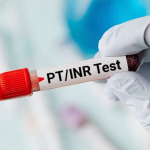 Prothrombin Time (PT PC/ INR)