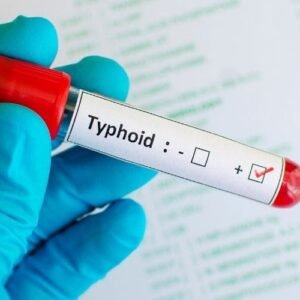 Typhidot (IgG & IgM)