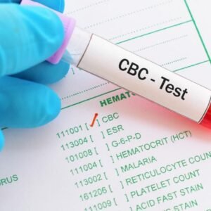 Complete Blood Count (CBC) 