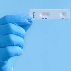 Hepatitis B Surface Antigen (HBsAg) Rapid Card Test