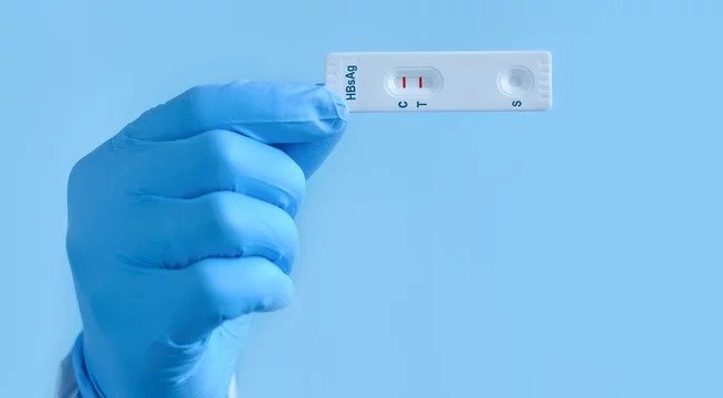 Hepatitis B Surface Antigen (HBsAg) Rapid Card Test