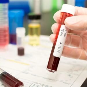HIV Elisa