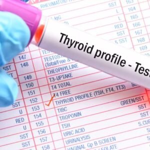 Thyroid Profile