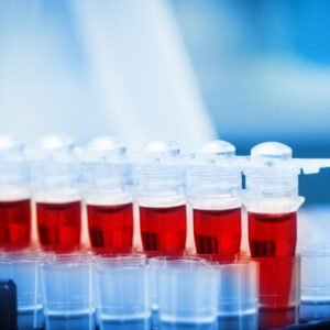 Serum,Amylase