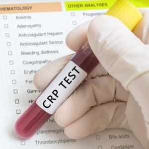 CRP(Quantitative)