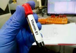 Vitamin B1 Thiamine