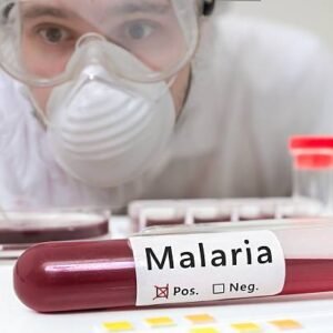 Malaria Parasite (M.P) Smear