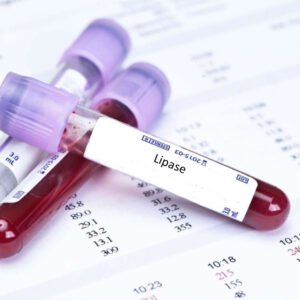 Lipase