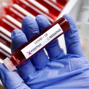 Covid RT PCR Test